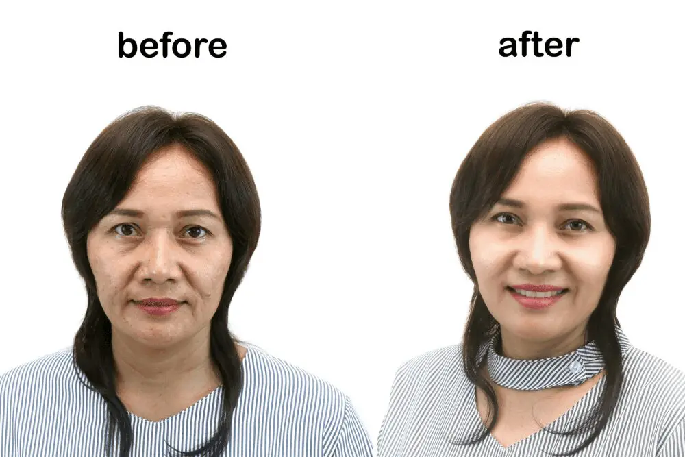 Woman's face before and after change