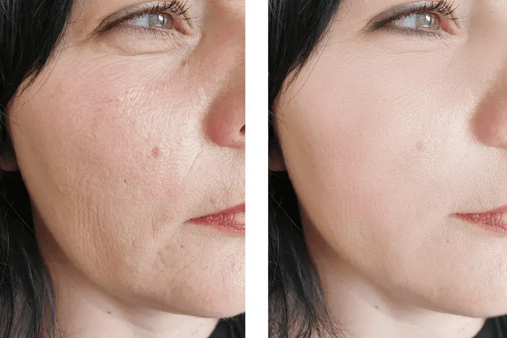Close-up of skin improvement results