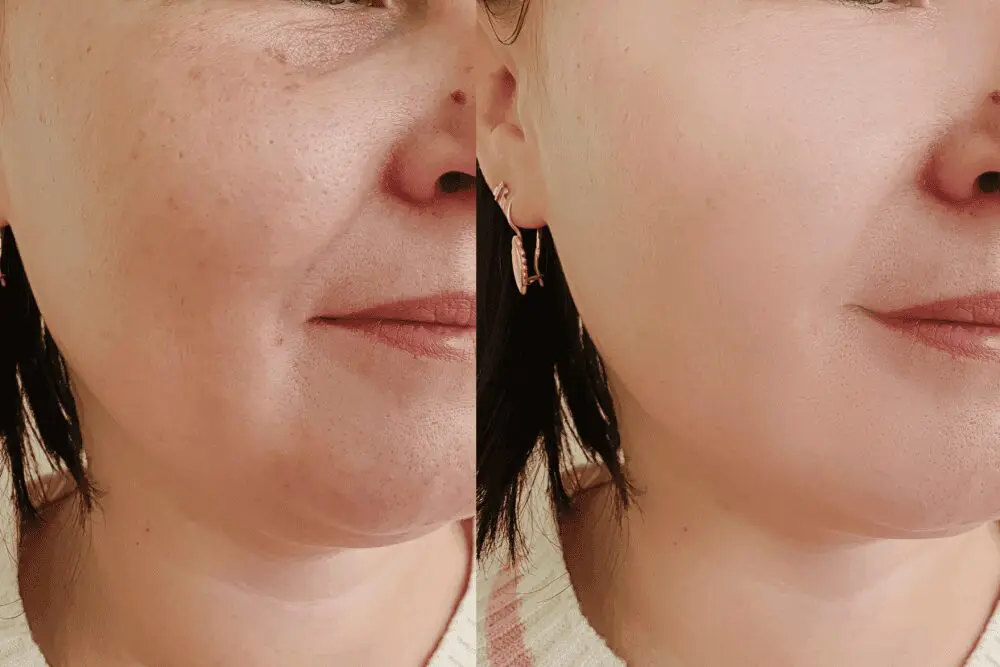 Visible skin texture enhancement results